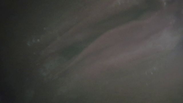 Vaginal Semen: Explore Intimate Moments
