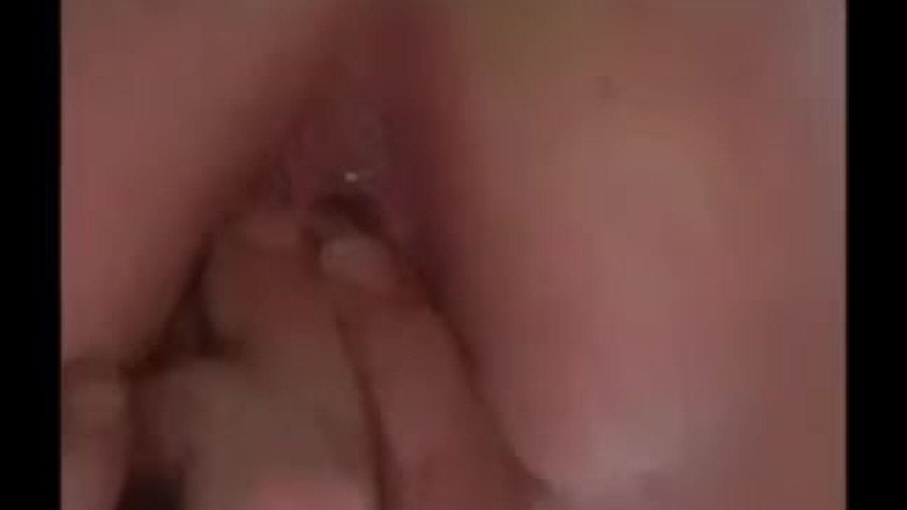 anal gaping
